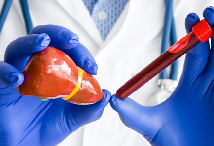 В России учёные создали тесты для раннего выявления рака печени