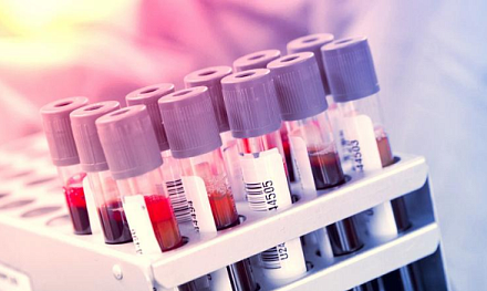 Пять показателей крови, которые говорят о проблемах в организме